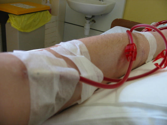 Dialysis in progress - image by Dan from United Kingdom - Flickr.com - image description page, CC BY 2.0, https://commons.wikimedia.org/w/index.php?curid=341039